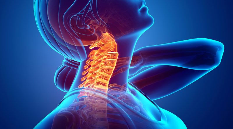 COUNT ON A GOOD CHIROPRACTOR FOR YOUR NECK PAIN CAUSED BY YOUR CELLPHONE